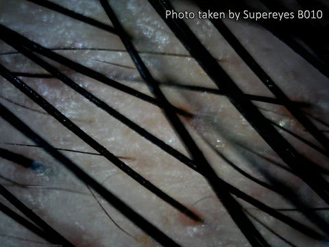 Supereyes B010 USB Digital Mikroskop Digitalmikroskop 1 bis 300-facher Vergrößerung mit LED-Beleuchtung und Stativ (Copy)